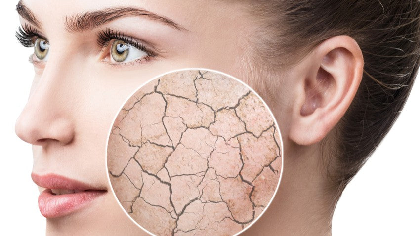Ingredients for dry skincare