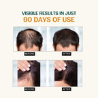 Advanced Hair Growth Serum with Rosemary Extract (Pack Of 2)