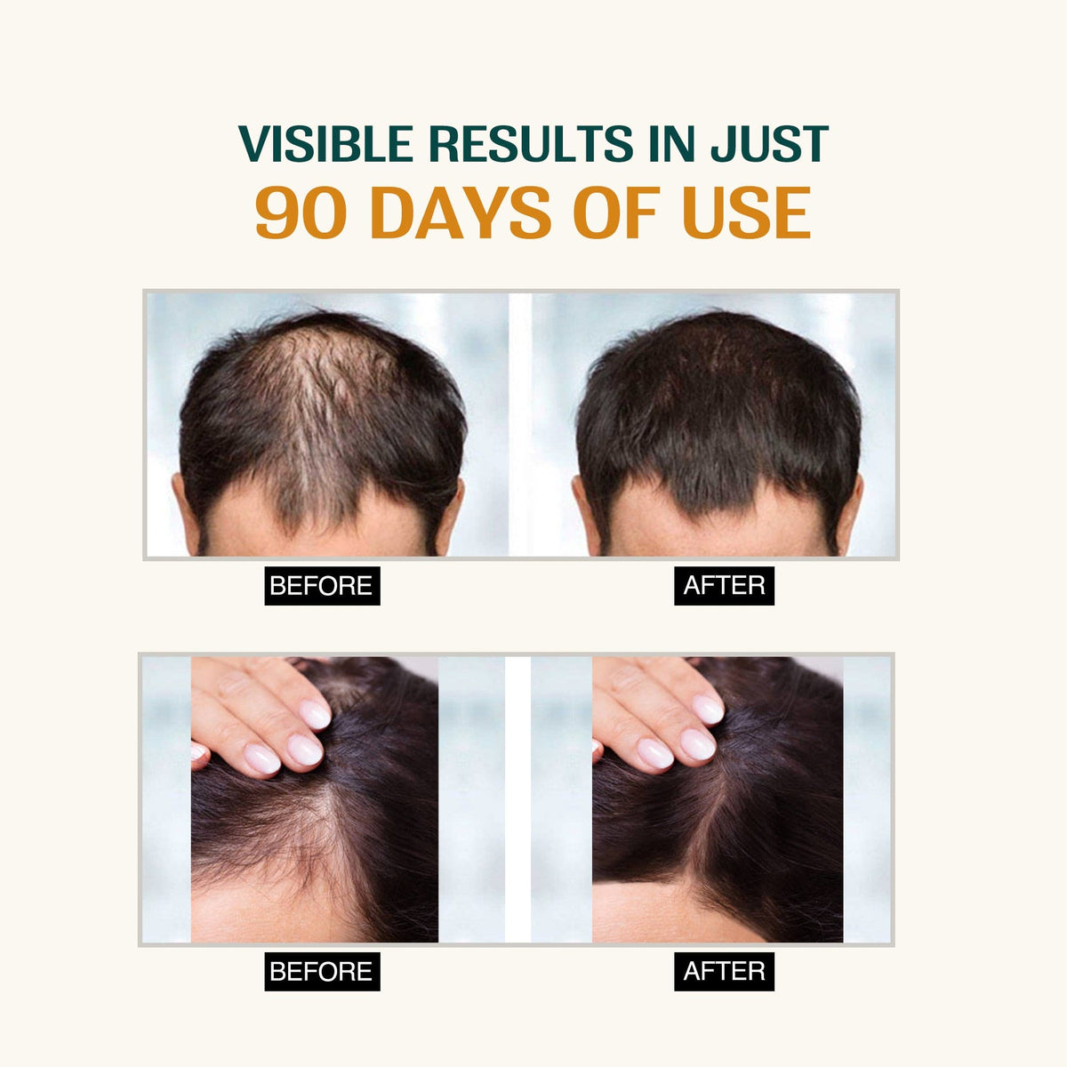 Advanced Hair Growth Serum with Rosemary Extract (Pack Of 2)