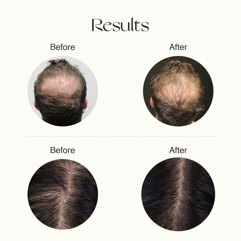 Advanced Hair Growth Serum