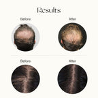 Advanced Hair Growth Serum
